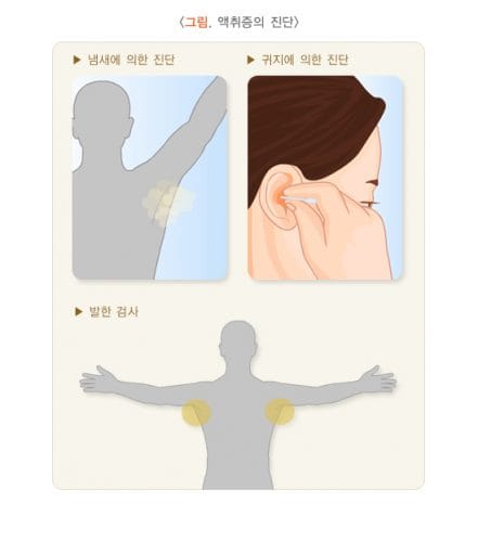 액취증, 고민 끝! 원인부터 치료, 사후관리 2 액취증 진단