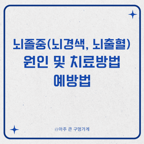 뇌졸중(뇌경색, 뇌출혈) 원인 및 치료방법, 예방법